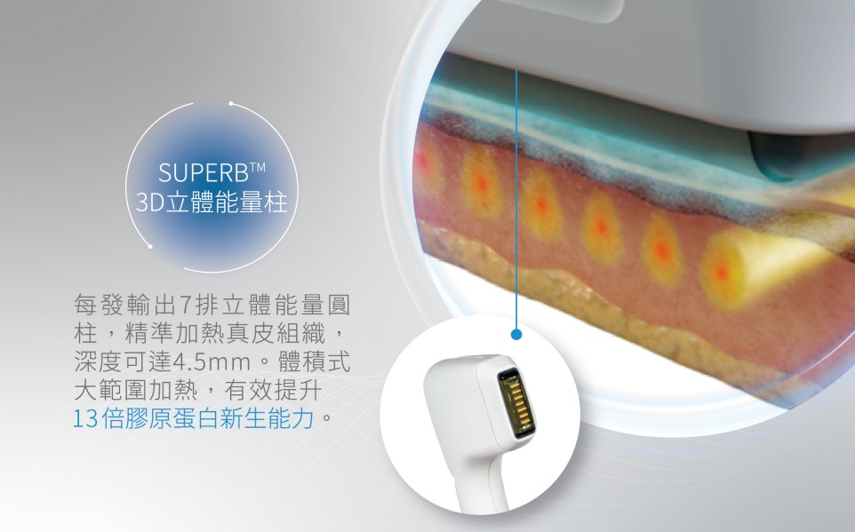 索夫波®的專利技術SUPERBTM3D立體能量柱，採用體積式加熱真皮層，擴大治療區域與有效加熱，並且專注在年輕關鍵『網狀層』，更有效促進膠原蛋白新生。