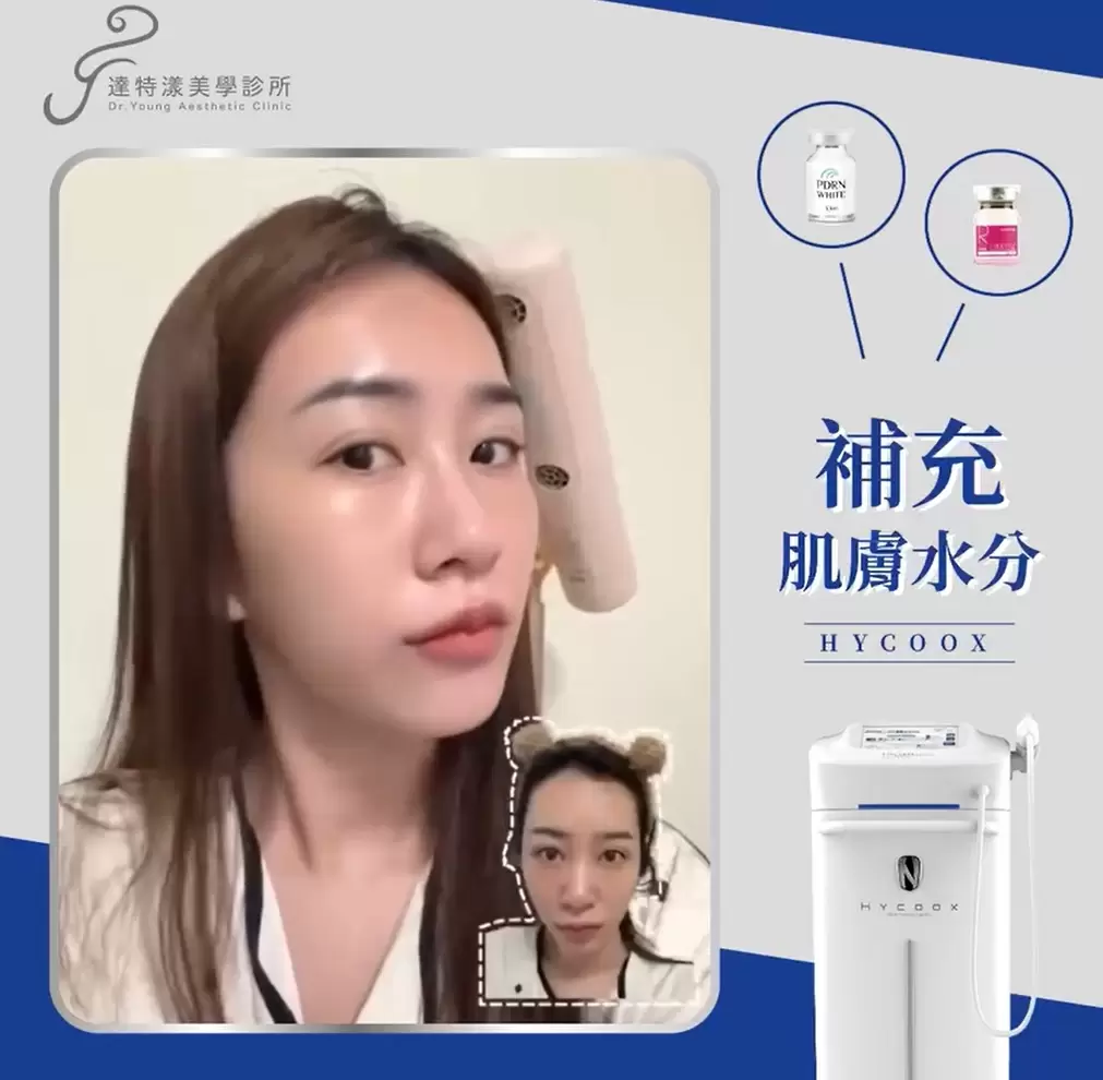 「水光注射」讓肌膚長時間水嫩透亮的秘密武器