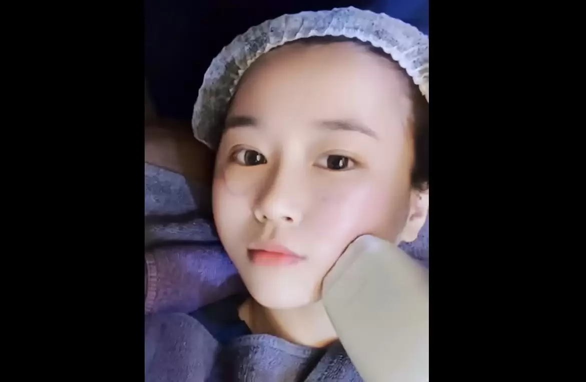 Sofwave索夫波 電波緊緻 音波拉提 雙重效果 改善鬆弛紋路 重現緊緻輪廓線