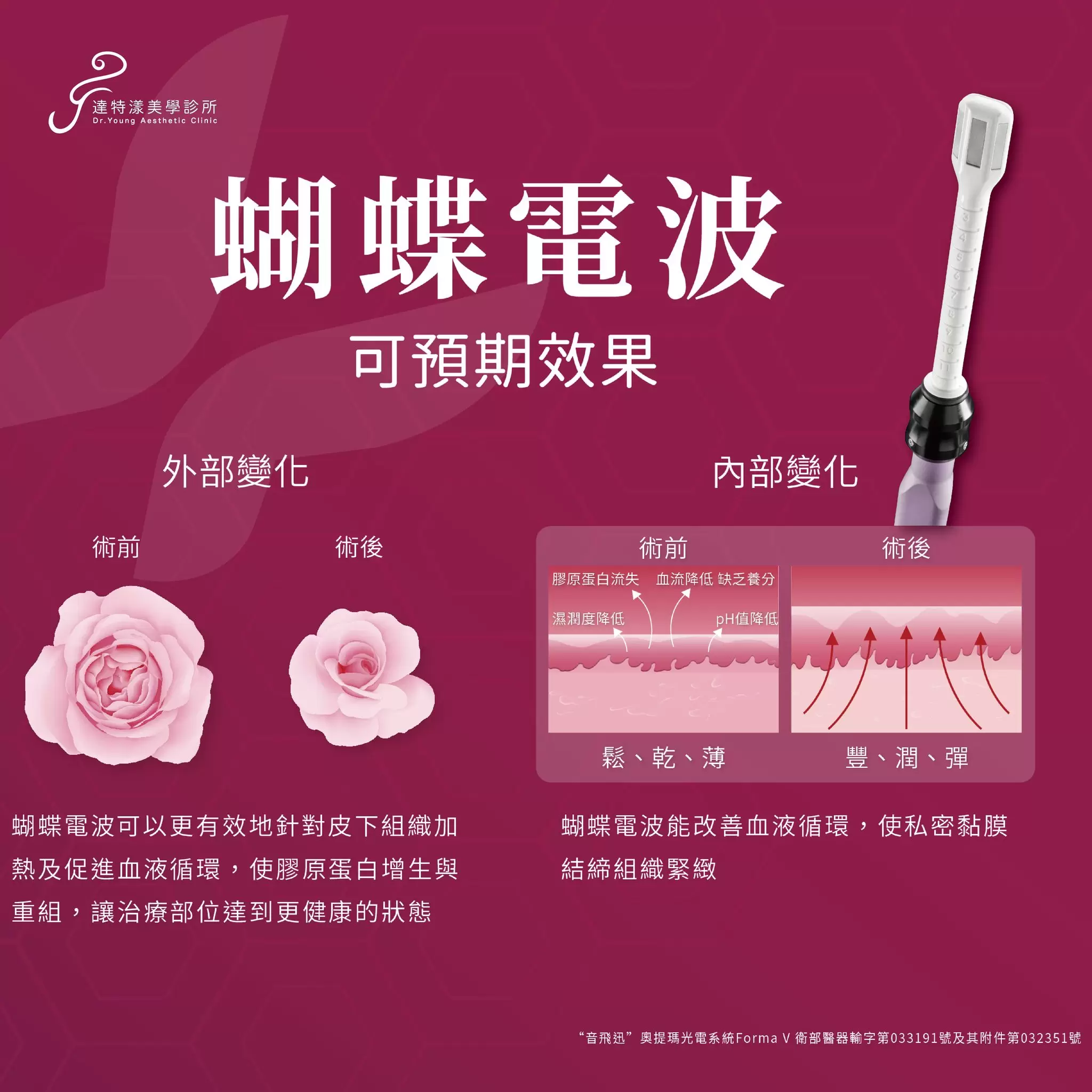  【FORMA V蝴蝶電波小教室】