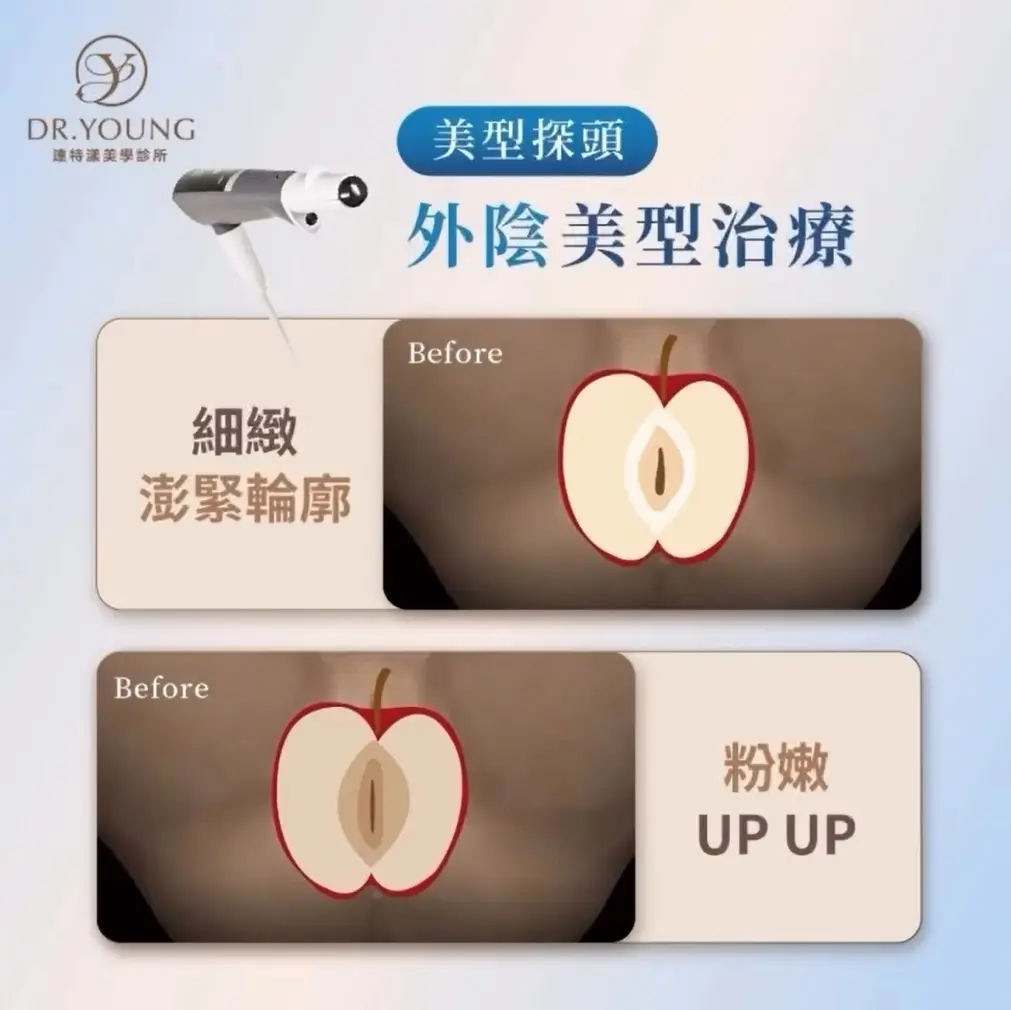 閨蜜電波｜私密處健康緊蜜澎潤美型計畫 真正的保養從不侷限在臉上