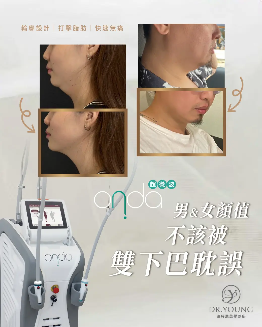 輪廓清晰，顏值自然到位｜昂達超微波ONDA