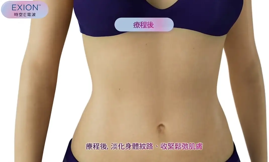 從臉到身體的呵護都交給時空E電波【EXION E電波】