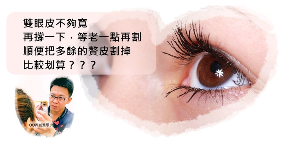 高雄雙眼皮_達特楊整形外科 高雄雙眼皮_達特楊整形外科
