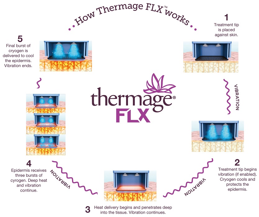 thermage FLX® (俗稱)鳳凰電波,當治療探頭接觸在肌膚上開始加熱時原理。