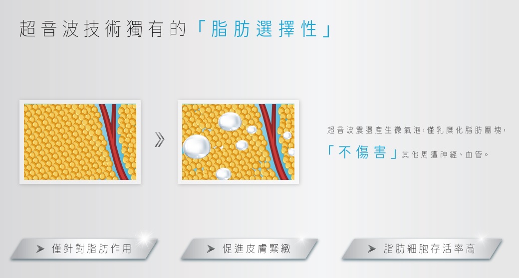 高雄音波脂雕超音波震盪產生的為氣泡,僅乳糜化脂肪團塊,不傷化周圍神經、血管。